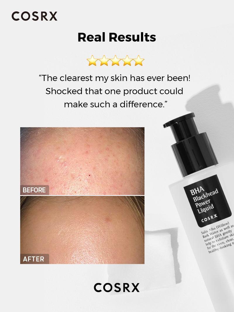 bha-blackhead-power-liquid-cosrx-official-4_1080x